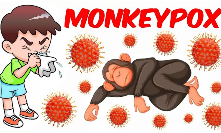 PREVENT | MONKEYPOX |POXVIRUS PREVENT | MONKEYPOX |POXVIRUS