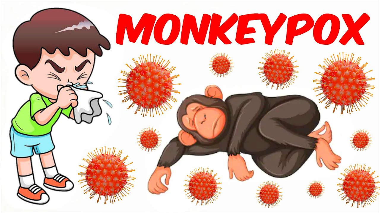 PREVENT | MONKEYPOX |POXVIRUS